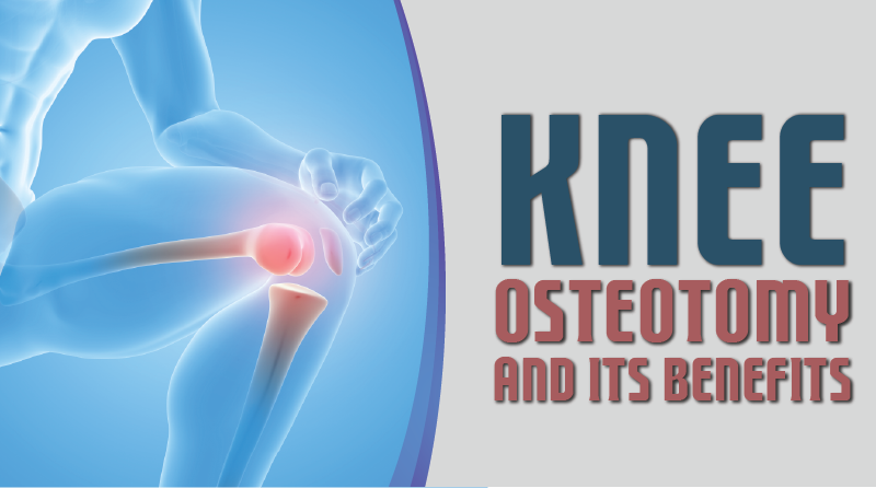 Knee Osteotomy and Its Benefits