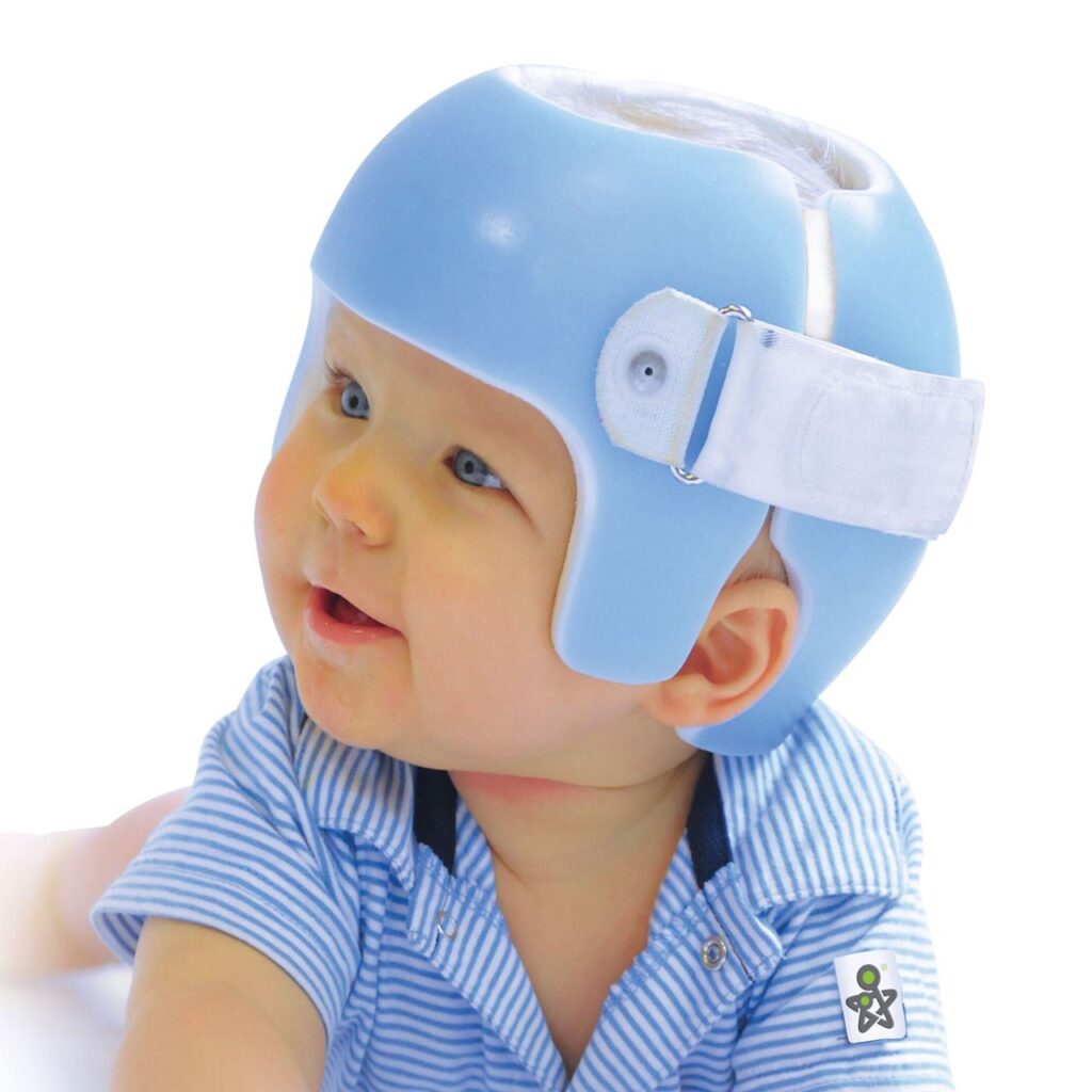 Cranial Remolding Helmet Market by Top Key Players, Types, Applications, Countries & Forecast to 2022-2030