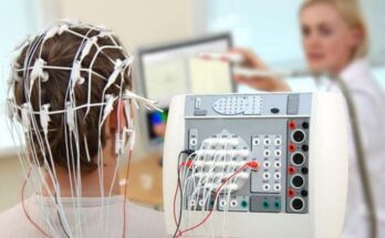 Electroencephalography Devices