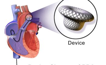Heart Closure Devices Market
